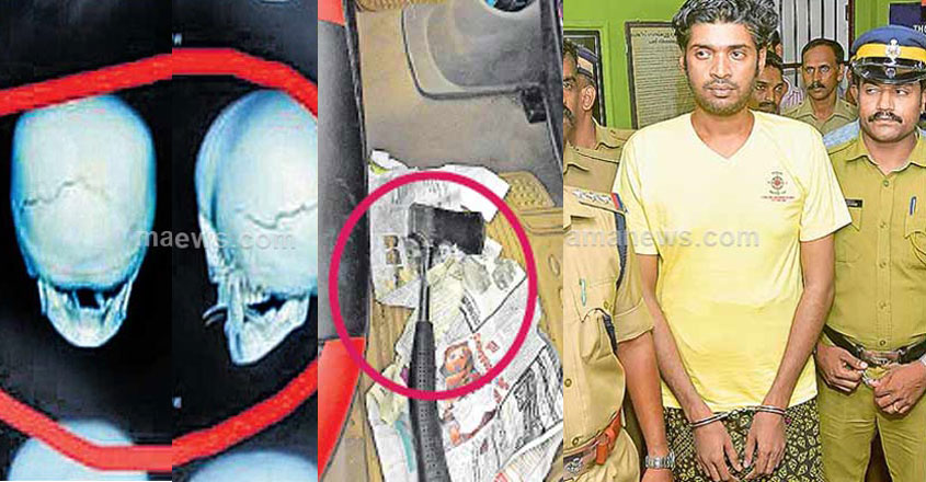 boy-attack-thodupuzha boy-attack-thodupuzha