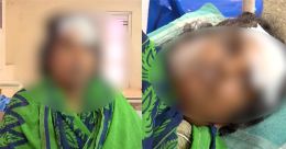 വീട്ടില് നിന്ന് പിടിച്ചിറക്കി സ്ത്രീകളടങ്ങുന്ന സംഘം മര്ദ്ദിച്ചു; രണ്ടു കൂട്ടർക്കുമെതിരെ കേസ് വീട്ടില് നിന്ന് പിടിച്ചിറക്കി സ്ത്രീകളടങ്ങുന്ന സംഘം മര്ദ്ദിച്ചു; രണ്ടു കൂട്ടർക്കുമെതിരെ കേസ്