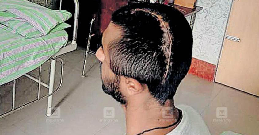 anoop-accident anoop-accident