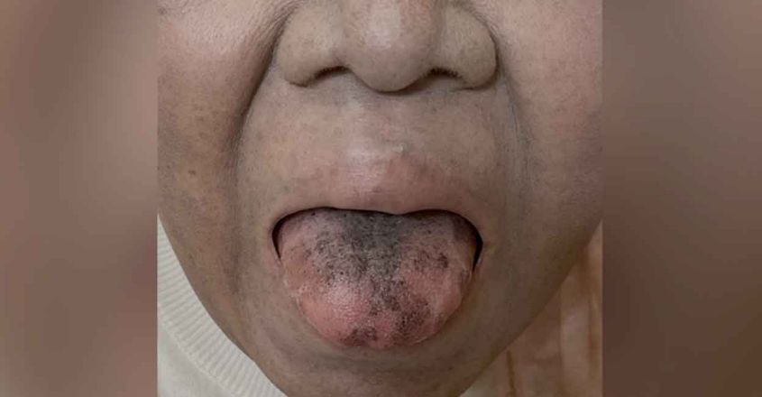 Image Credit: casereports.bmj.com