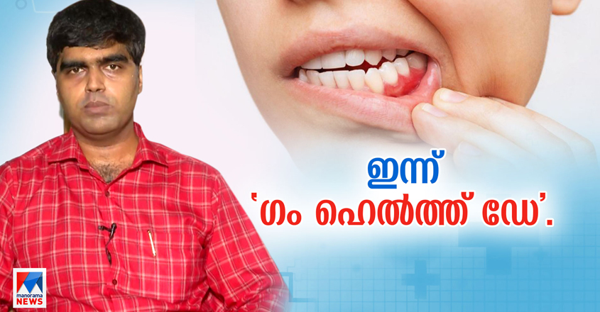 gum-disease-gingivitis-periodontitis-world-gum-health-day
