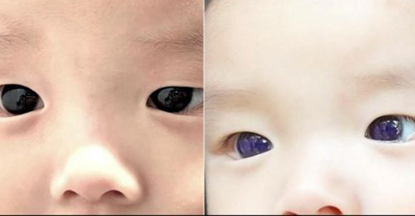 eyeswb