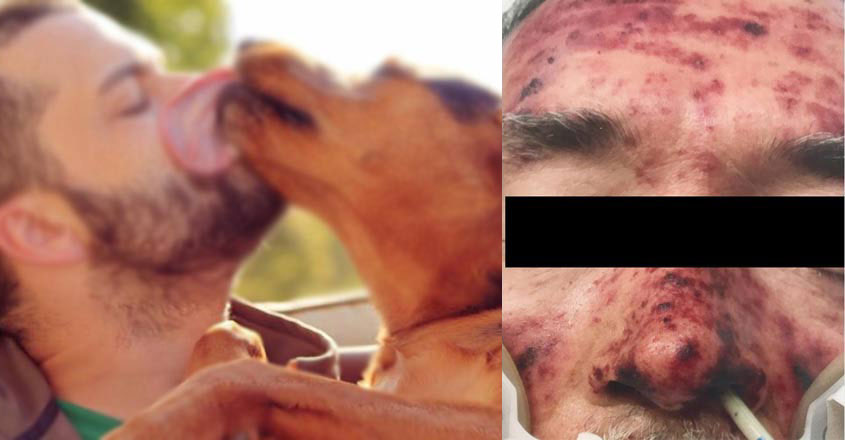 dog-bite-pic dog-bite-pic