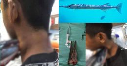 മീൻ പിടിക്കാനിറങ്ങി; കഴുത്തിൽ തുളച്ച് കയറി സൂചി മൽസ്യം; അദ്ഭുതരക്ഷ മീൻ പിടിക്കാനിറങ്ങി; കഴുത്തിൽ തുളച്ച് കയറി സൂചി മൽസ്യം; അദ്ഭുതരക്ഷ