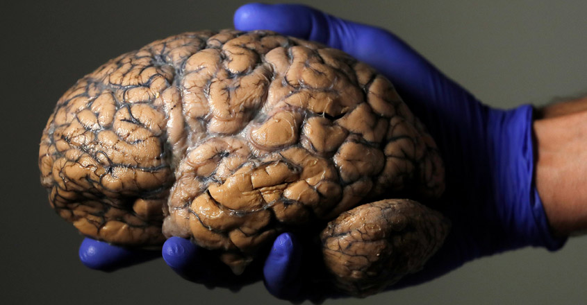Belgian researcher Jeroen Schuermans holds a human brain, part of a collection of more than 3,000 brains that could provide insight into psychiatric diseases, at the psychiatric hospital in Duffel, Belgium, July 19, 2017.    REUTERS/Yves Herman      TPX IMAGES OF THE DAY