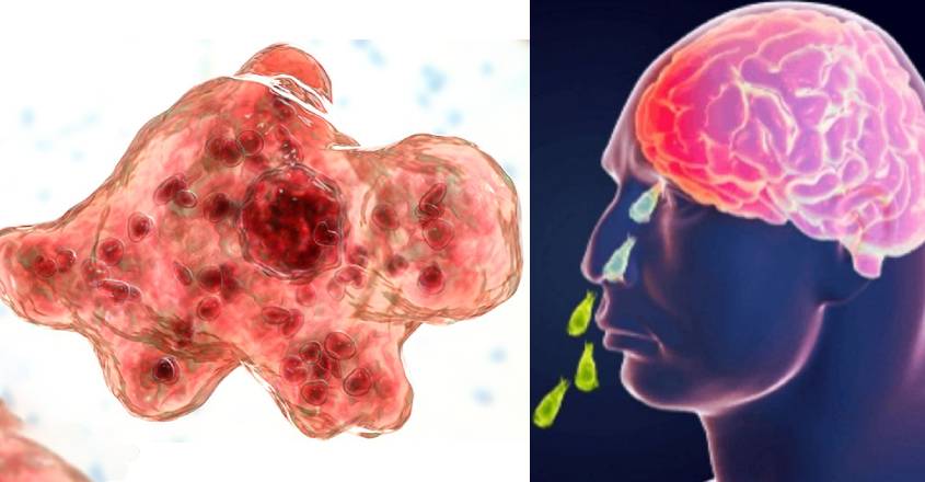 brain-eating-Naegleria-fowleri