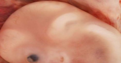 Embryo.jpg.image